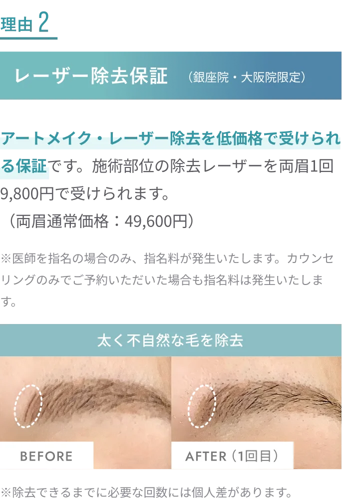 理由2 レーザー除去保証（銀座院・大阪院限定）
