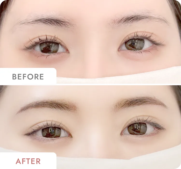 小林真緒の症例写真
