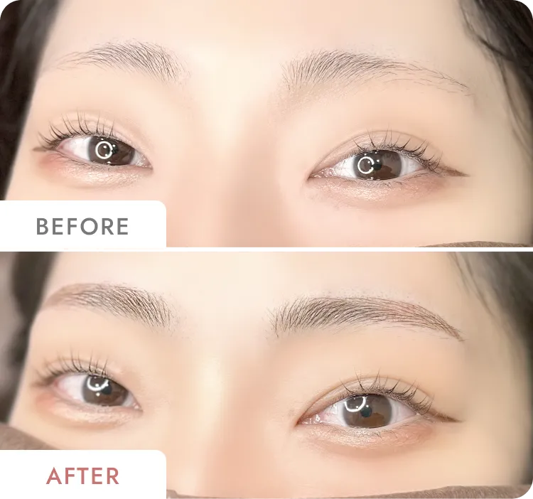 厚見 なつきの症例写真