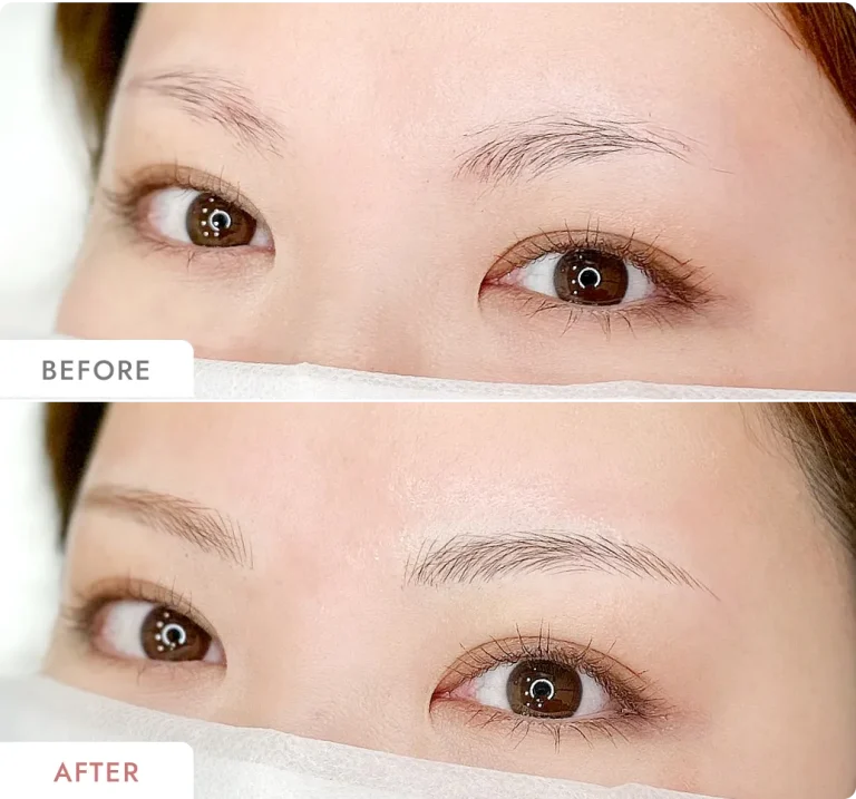 堀木菜々恵の症例写真