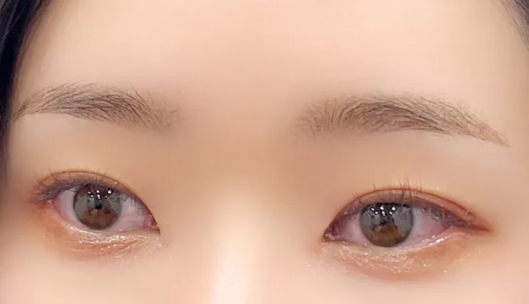 形が整わないお悩みを整え、自然で美しい平行眉に仕上げました。