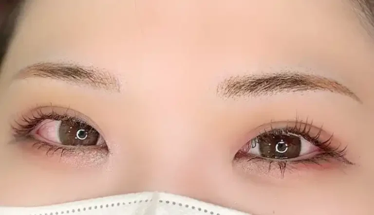 After