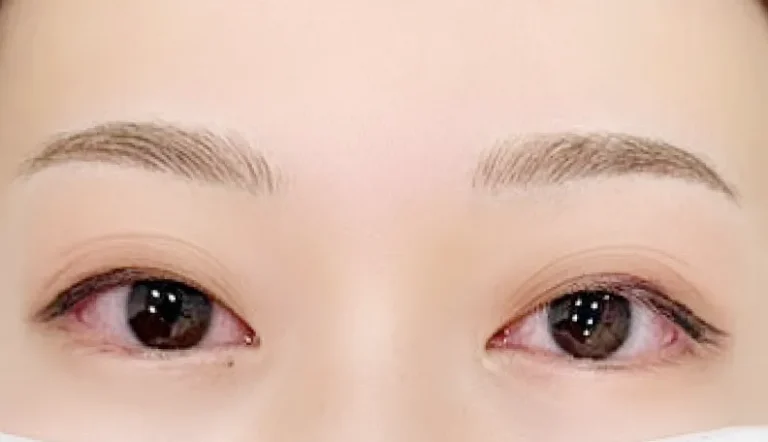 After