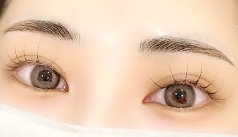 After