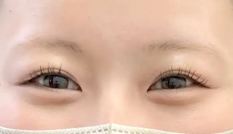 眉アートメイクの施術前｜FIRST ARTMAKE 大阪梅田本院・担当 かわかみ ゆか