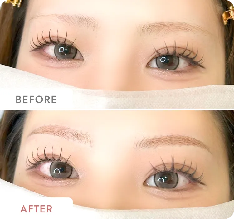 日比野 芽生の症例写真